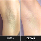 Depilador Profissional À Laser - Silk Pro